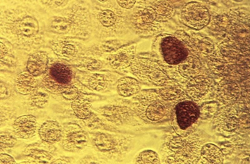 chlamydia treatment