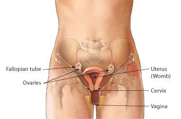 pelvic inflammatory disease
