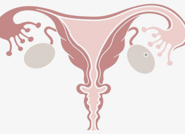 pelvic inflammatory disease