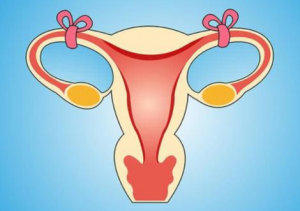 blocked fallopian tube