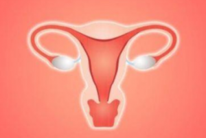 Endometriosis
