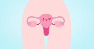 premature ovarian failure
